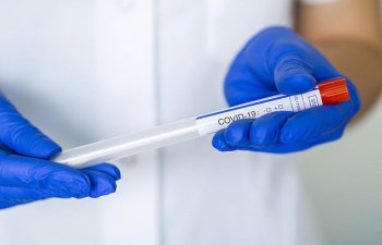 Azərbaycanda koronavirusdan ölənlərin sayı artdı