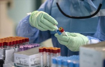 Azərbaycanda indiyədək 2 102 957 koronavirus testi aparılıb
