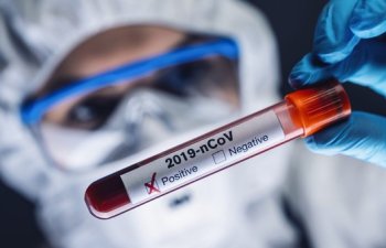 Azərbaycanda indiyədək 2129291 koronavirus testi aparılıb
