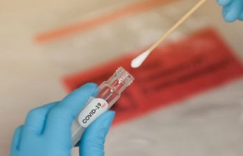 Azərbaycanda indiyədək aparılmış koronavirus testlərinin SAYI AÇIQLANDI