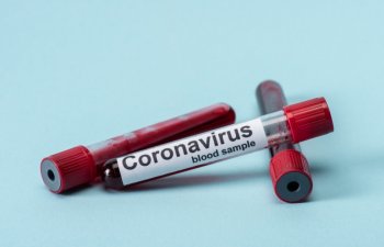 Azərbaycanda son sutkada 532 yeni yoluxma