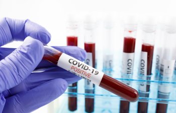 Azərbaycanda indiyədək 2287959 koronavirus testi aparılıb