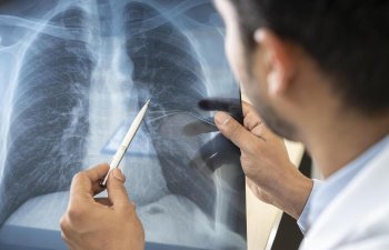 Alimlərdən 10 illik koronavirus proqnozu