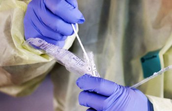 Simptomsuz koronavirus keçirdiyimizi necə müəyyən edə biərik?