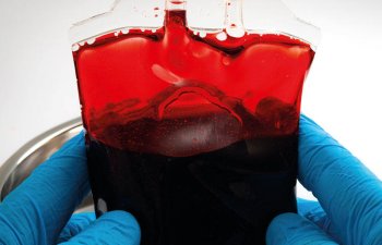 Siqaret çəkənlər qan donoru ola bilərmi?