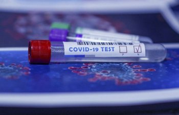 Azərbaycanda indiyədək neçə koronavirus testi aparılıb?