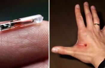 Bill Qeytsdən ÇİP AÇIQLAMASI: \