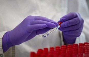 D vitamini çatışmazlığını göstərən qeyri-adi simptomlar