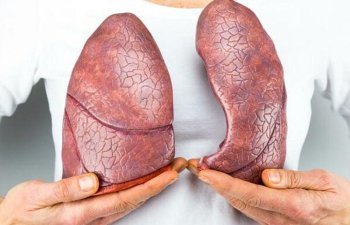 Koronavirus ciyərləri bu hala salır - ARAŞDIRMA