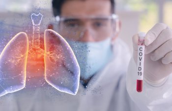 Son sutkada koronavirusa yoluxanların SAYI AÇIQLANDI