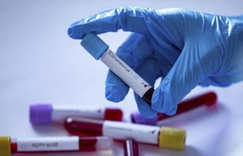 Son sutkada 20 nəfər koronavirusdan vəfat edib – STATİSTİKA