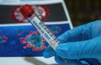Son sutkada koronavirus yoluxanların SAYI AÇIQLANDI