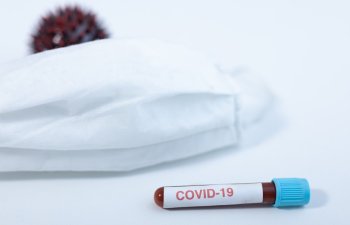 Koronavirusdan ölən olmayıb – STATİSTİKA