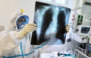 Koronavirusla bağlı SON STATİSTİKA