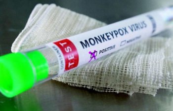 Türkiyədə meymunçiçəyinə ilk yoluxma TƏSDİQLƏNDİ