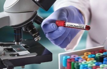 Koronavirusla bağlı SON STATİSTİKA