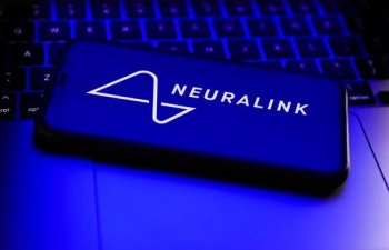 Maskın çılğın layihəsi Neuralink-də insan təcrübələri gəlir