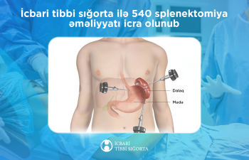 İcbari tibbi sığorta ilə 540 splenektomiya əməliyyatı icra olunub