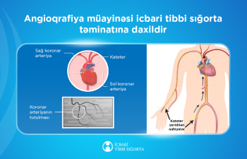 İcbari tibbi sığorta ilə 50 mindən artıq angioqrafiya müayinəsi aparılıb