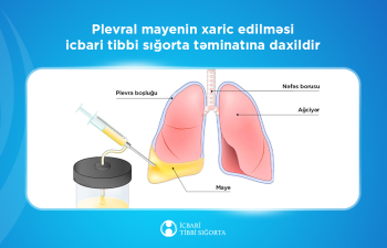 Ağciyərlərə yığılmış mayenin çəkilməsi məqsədilə 5643 prosedur icra olunub