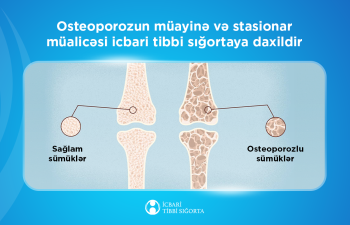Osteoporozun müayinə və stasionar müalicəsi icbari tibbi sığortaya daxildir