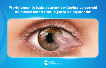 Ötən il ərzində icbari tibbi sığorta hesabına 2192 sayda gözdə ət artımı əməliyyatı icra olunub