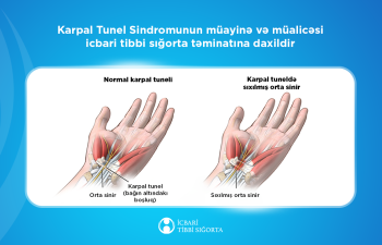 Karpal Tunel Sindromunun müayinə və müalicəsi icbari tibbi sığorta təminatına daxildir