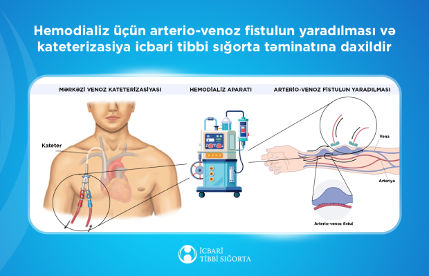 İcbari tibbi sığorta hesabına 1480-dən çox ilkin hemodializ xidməti göstərilib