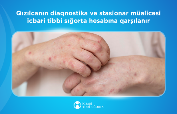 Qızılcanın diaqnostika və stasionar müalicəsi icbari tibbi sığorta hesabına qarşılanır