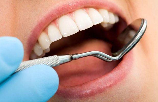 Diş plomblarında inqilabi yenilik: Bioaktiv şüşə bakteriyaları 61% azaldır