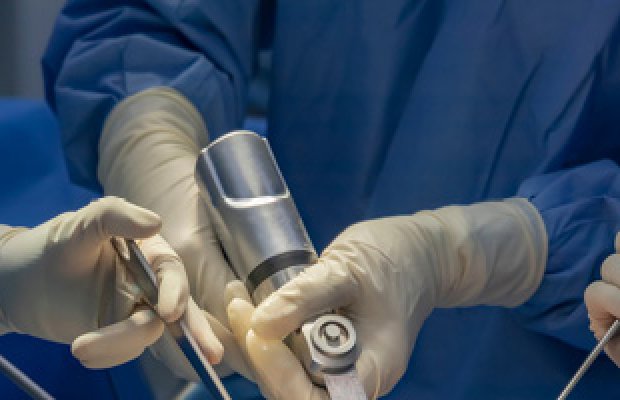 Yeni texnologiya ilə implantatlarda iltihab riski 5–12 dəfə azalır – Pərm Polytex və URA RAN
