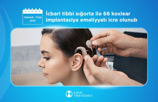 Koxlear implantasiya əməliyyatı zamanı implant və nitq prosessorunun xərclərini icbari tibbi sığorta qarşılayır